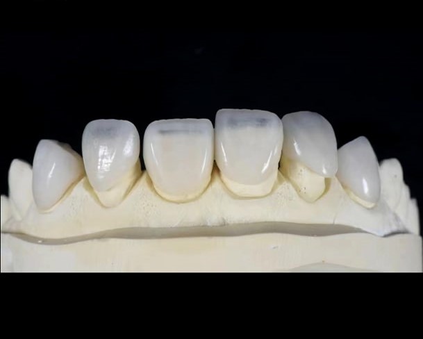 imgpsh_fullsize_anim (1)